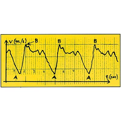 Swimsportec Schwimmgeschwindigkeits-Mess-System „Speedometer“ Ansicht 3